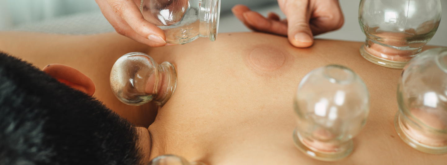 TCM professional performing cupping treatment on client