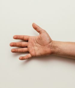 Thumbnail_Wellness_HandTherapy