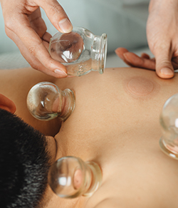 TCM professional performing cupping treatment on client